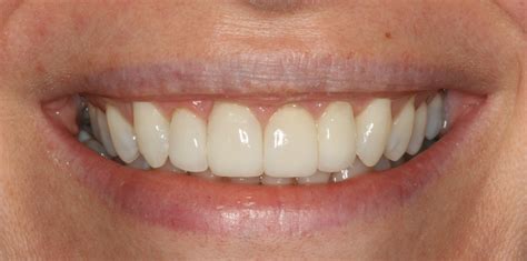 cosmetic dentist dartford